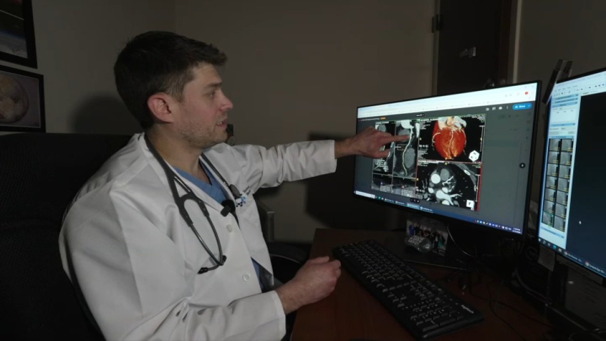 NJ hospital using AI, cutting-edge imaging for clearer heart screenings